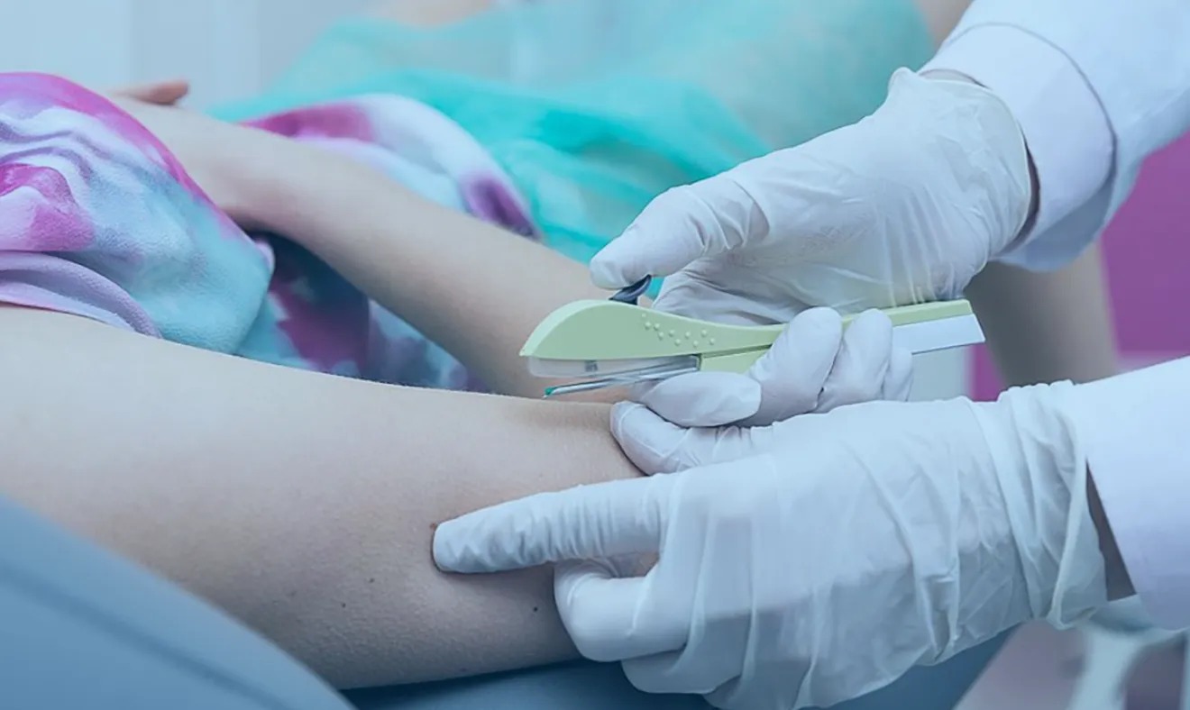 João Pessoa passa a oferecer implante contraceptivo pelo SUS