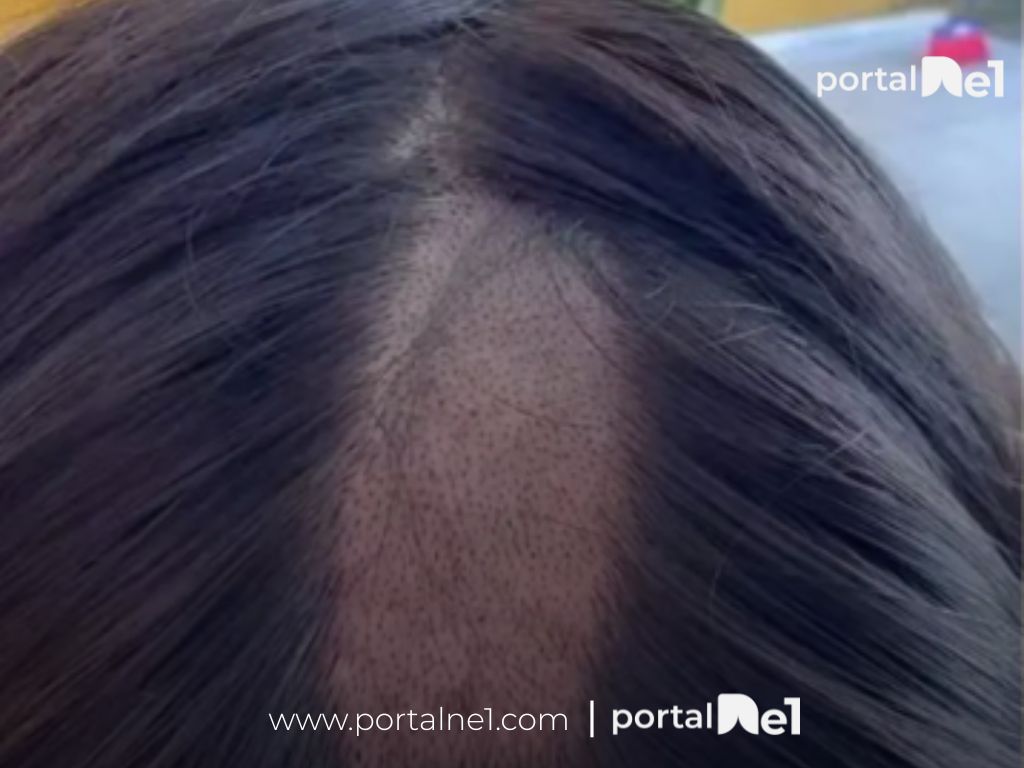 Mulher relata ter parte do cabelo raspada durante exame para primeira CNH na Paraíba