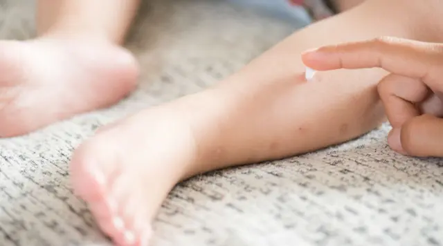 Alergia alimentar afeta até 8% das crianças menores de 3 anos