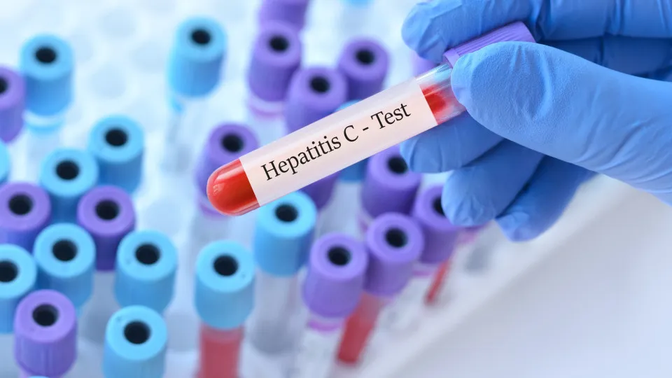 Hepatite viral mata 20,9% dos idosos internados no SUS